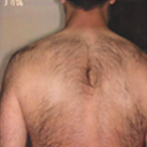 Before treatment