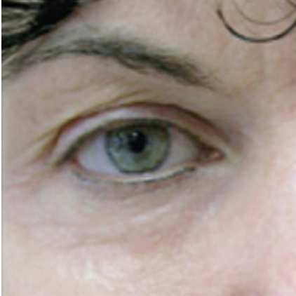 After treatment