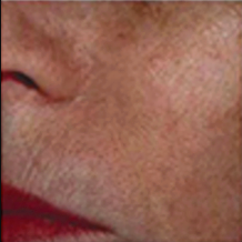 After treatment
