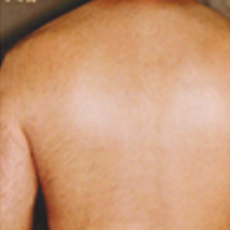 After treatment